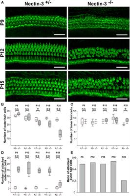 Hearing loss in mice with disruption of auditory epithelial patterning in the cochlea